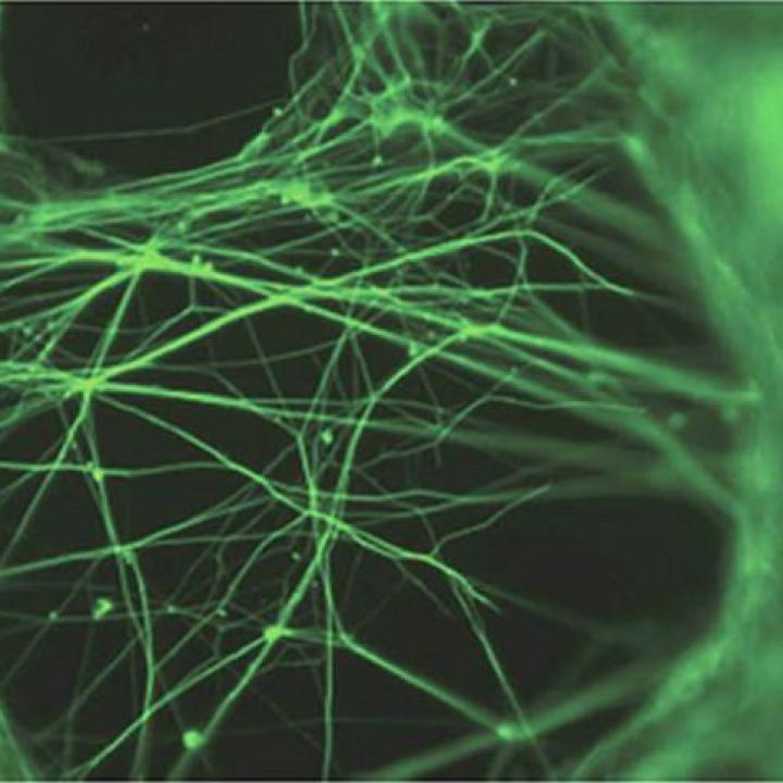 Laboratory-grown nerve cells, shown with fluorescent green dye against a black background
