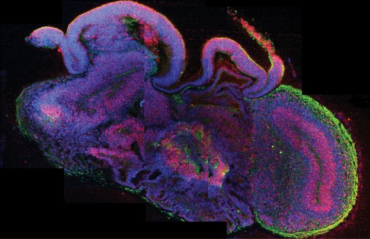 Fluorescent microscope image showing a cross section of a cerebral organoid