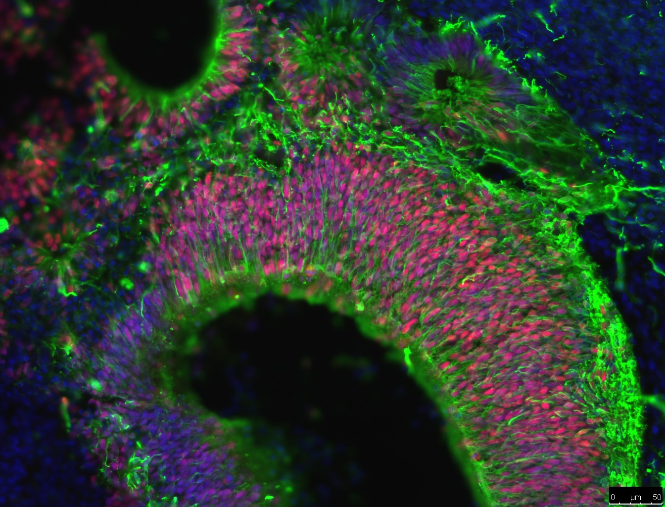 Fluorescently labelled cells in a brain organoid