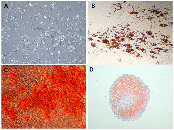 Microscopy image in four quadrants, showing MSCs, adipocytes (fat cells), osteoblasts (bone cells), and chondrocytes (cartilage cells)