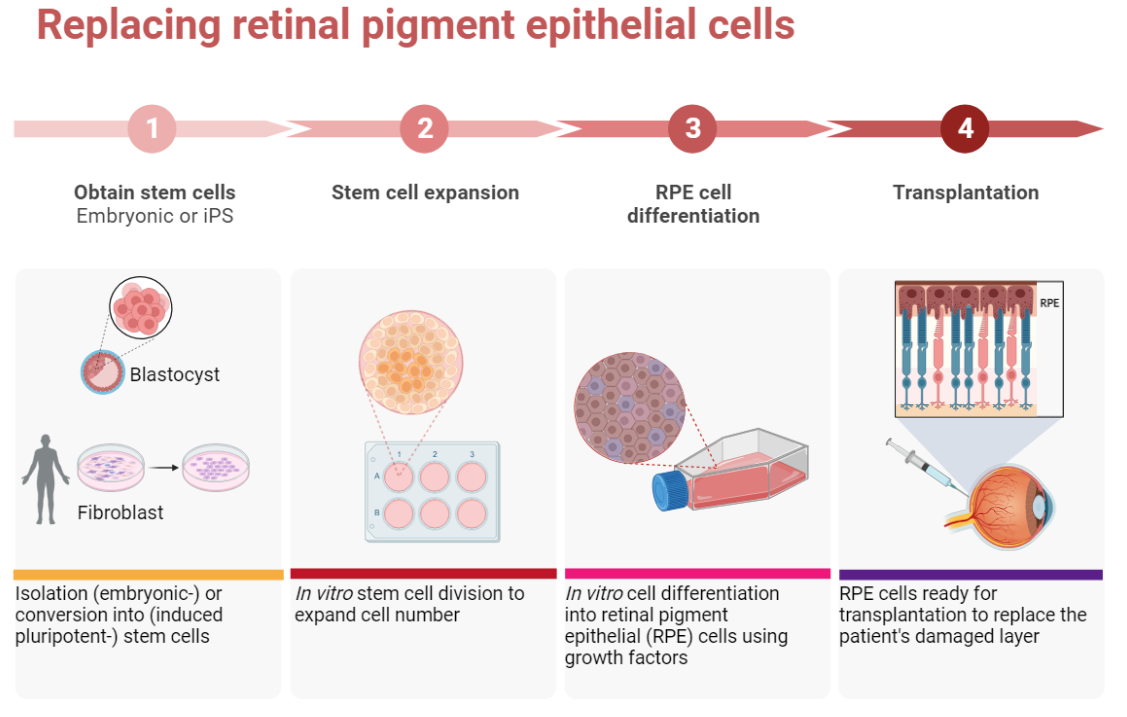 Diagram showing the cultivation of retinal pigment epithelial cells