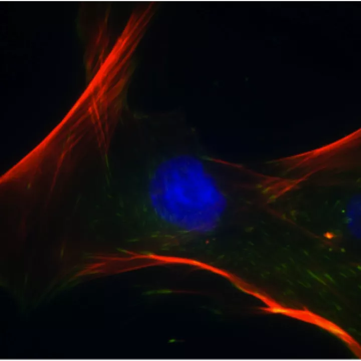 Menschliche mesenchymale Stammzellen