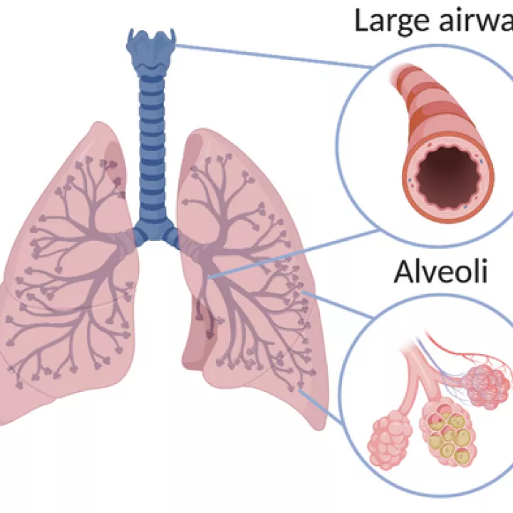 Diagram of the lung showing the large airway and alveoli