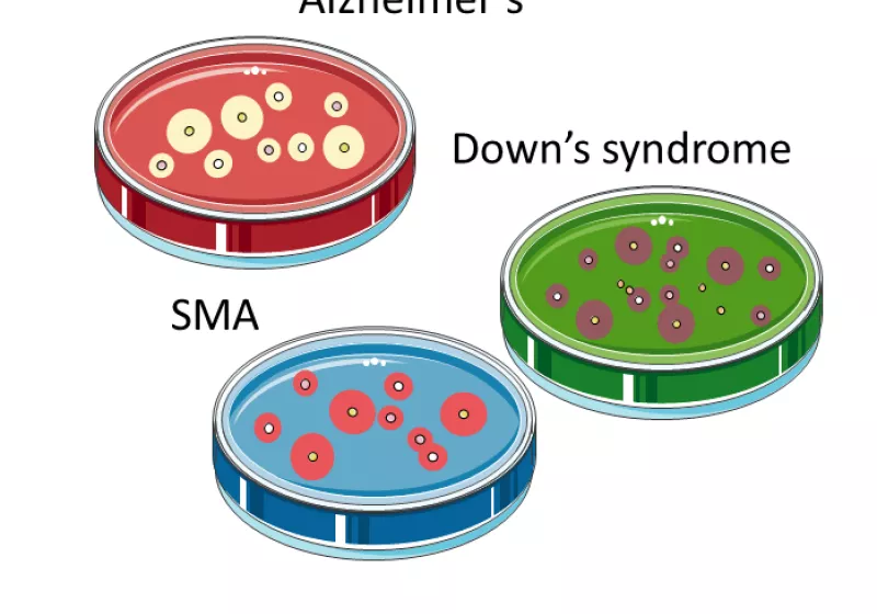 New tools for disease research: reprogrammed cells in disease modelling